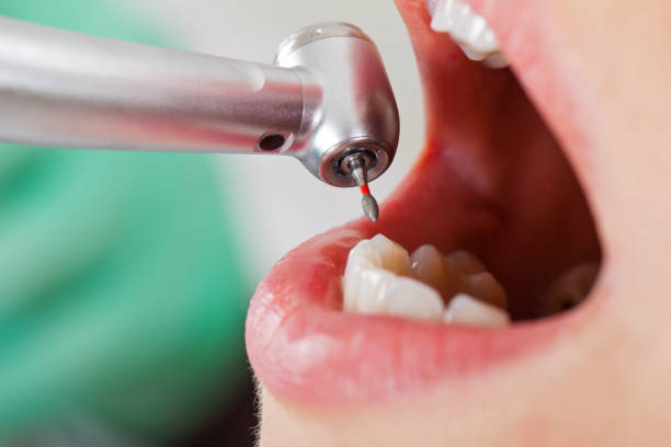 Best Knocked-Out Tooth Emergency  in Long Lake, IL